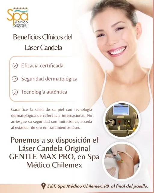 Láser Candela